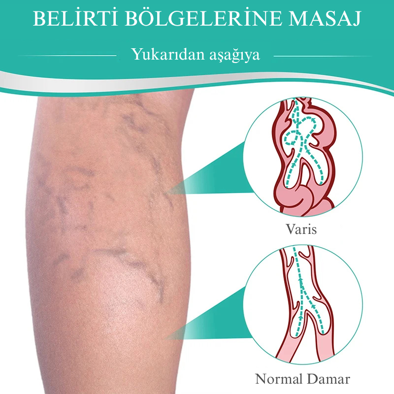 VenaRelief™ Varis Bandı – Doğal Rahatlama, Pürüzsüz Bacaklar