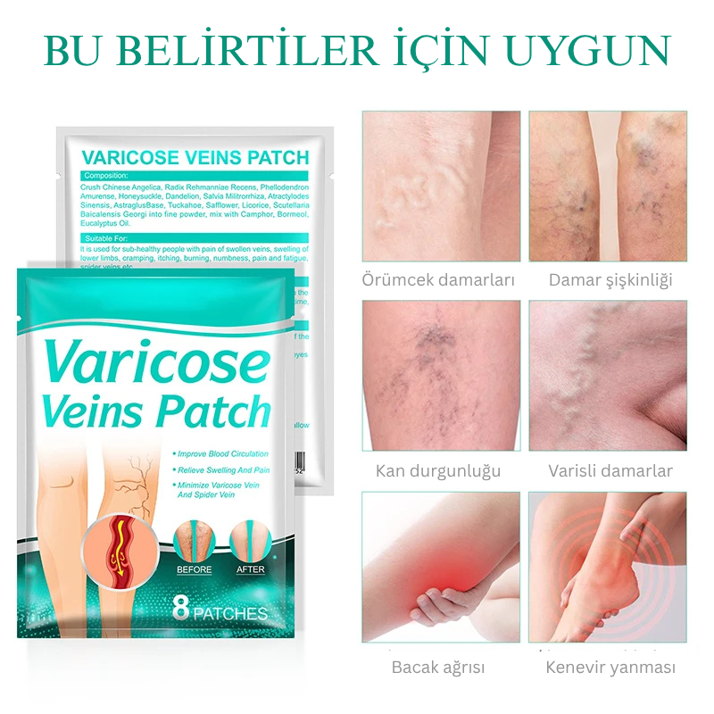VenaRelief™ Varis Bandı – Doğal Rahatlama, Pürüzsüz Bacaklar