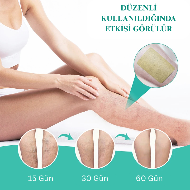 VenaRelief™ Varis Bandı – Doğal Rahatlama, Pürüzsüz Bacaklar