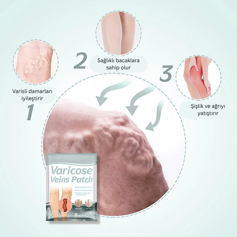 VenaRelief™ Varis Bandı – Doğal Rahatlama, Pürüzsüz Bacaklar