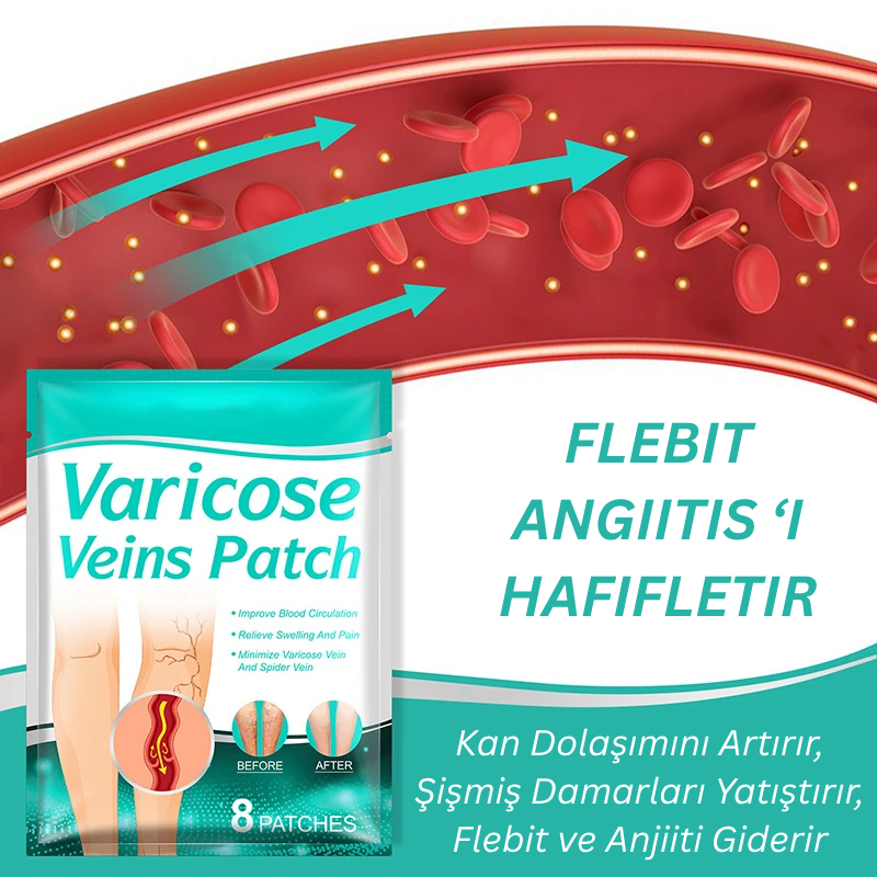 VenaRelief™ Varis Bandı – Doğal Rahatlama, Pürüzsüz Bacaklar
