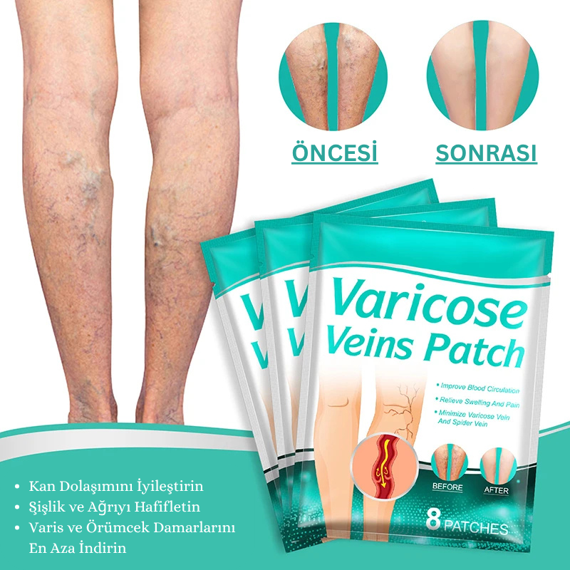 VenaRelief™ Varis Bandı – Doğal Rahatlama, Pürüzsüz Bacaklar