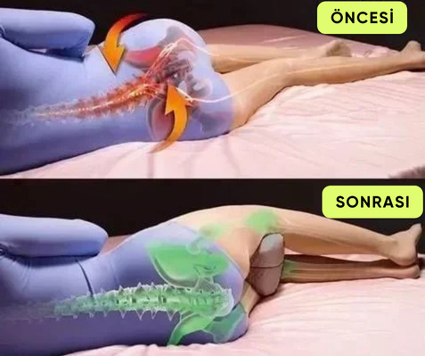 BelKonfor Ortopedik Omurga Destek Yastığı