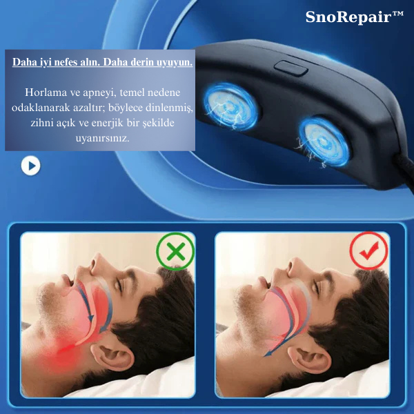 SnoRepair™ | Uyku Apne ve Horlama Önleyici Nörostimülasyon Cihazı