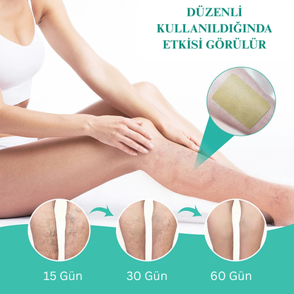 VenaRelief™ Varis Bandı – Doğal Rahatlama, Pürüzsüz Bacaklar