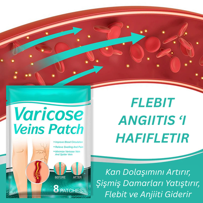 VenaRelief™ Varis Bandı – Doğal Rahatlama, Pürüzsüz Bacaklar